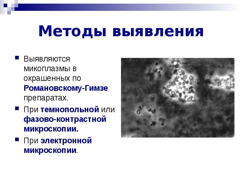 Методы выявления микоплазм микробиология. Микоплазмы при темнопольной микроскопии. Микоплазма морфология микробиология. Микоплазмы фазово контрастная микроскопия.