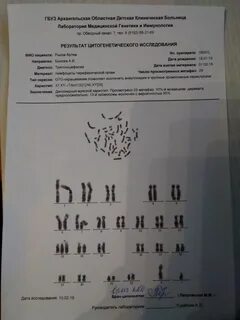 Анализ на кариотип