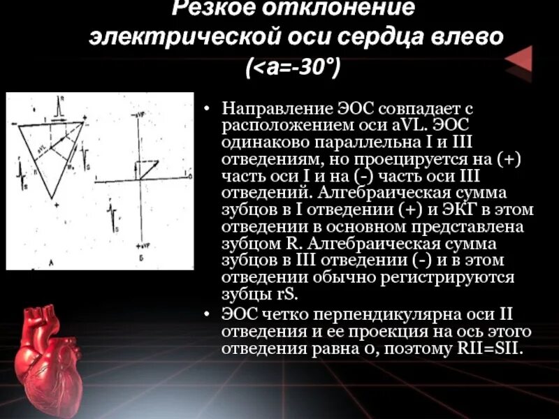 Отклонение электрической оси сердца вправо. Отклонение оси вправо на экг. Изменение положения сердца у детей. Сердце отклонено вправо что это. Электрическая ось сердца отклонена вправо.