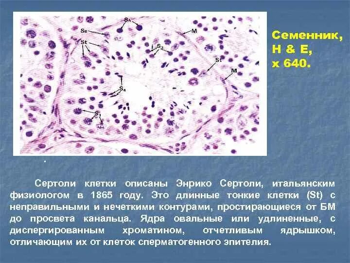 Длинные и тонкие клетки. Клетки сертоли гистология препарат. семенник гистология клетки сертоли. сустентоциты семенника гистология. клетки сертоли в семенниках.