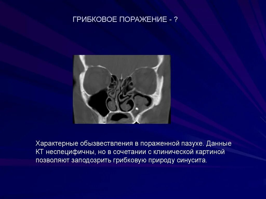 Данные кт