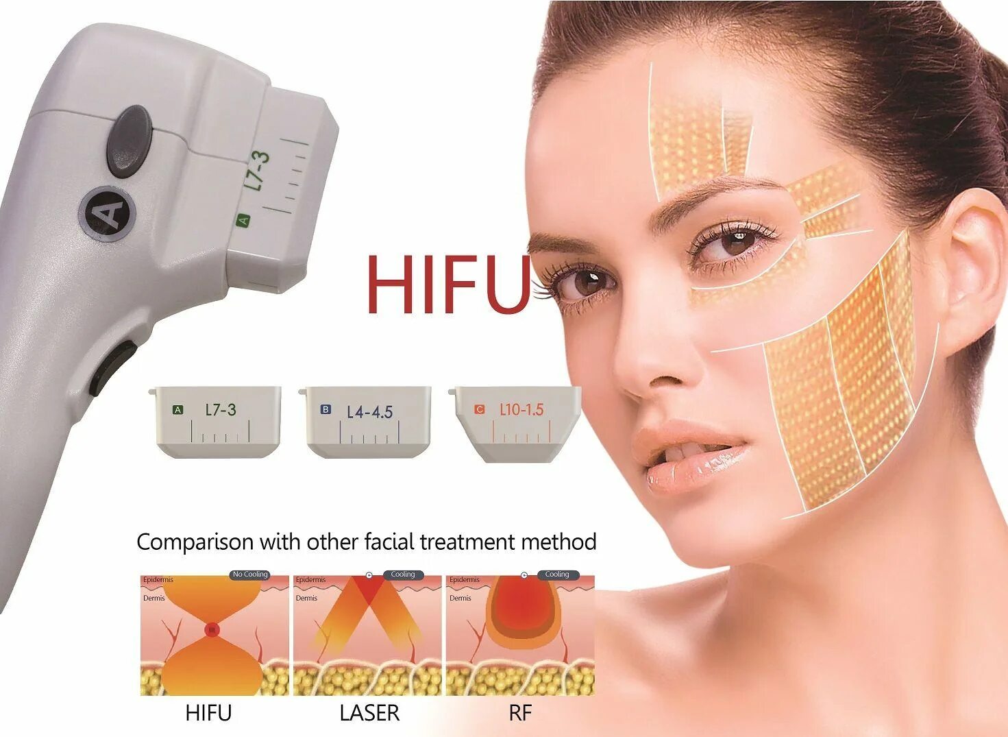 Альтера смас лифтинг век. Стоит делать смас лифтинг. Ультраформер лифтинг. Альтера ультразвуковой лифтинг. Hifu 7d аппарат.