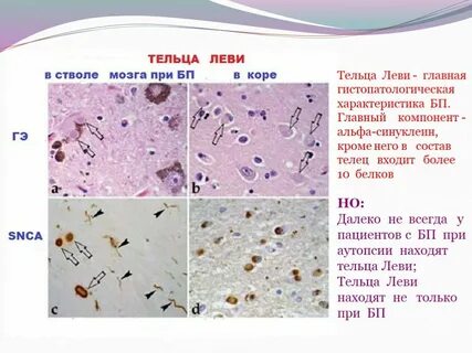 Тельца леви