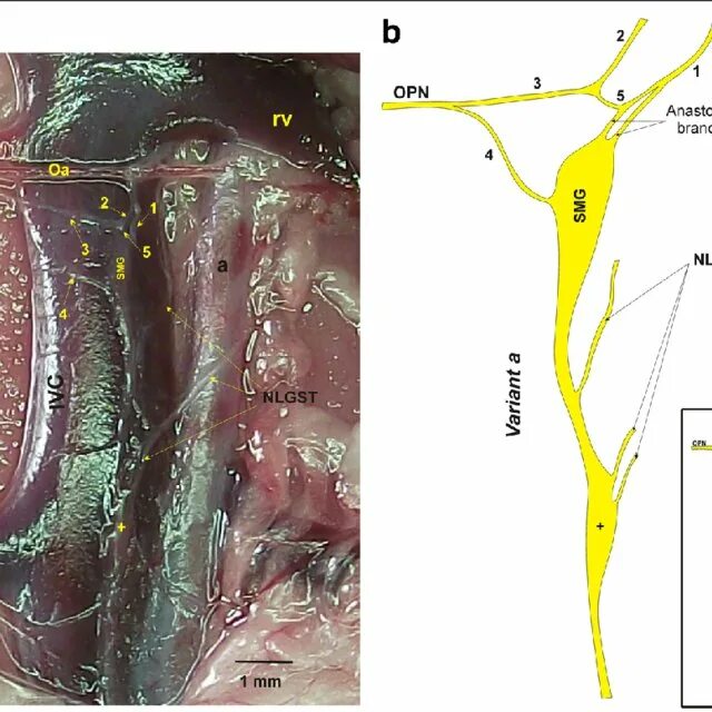 Седалищный нерв крысы поперечное сечение. Plexus pampiniformis женщин. Тонкий нерв крысы.