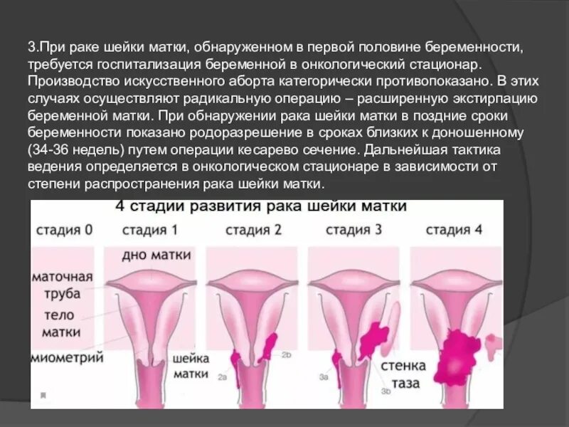 Что делают при раке шейки матки. Кровотечение матки при онкологии. шейка матки в 1 половине берем. шейки матки ранняя беременность.