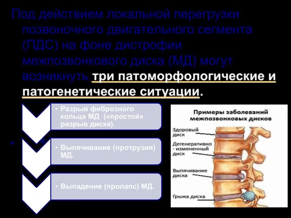 Разрыв диска позвоночника. Двигательный сегмент позвоночника. Сегменты позвоночных дисков позвоночника. ПДС позвоночника это.