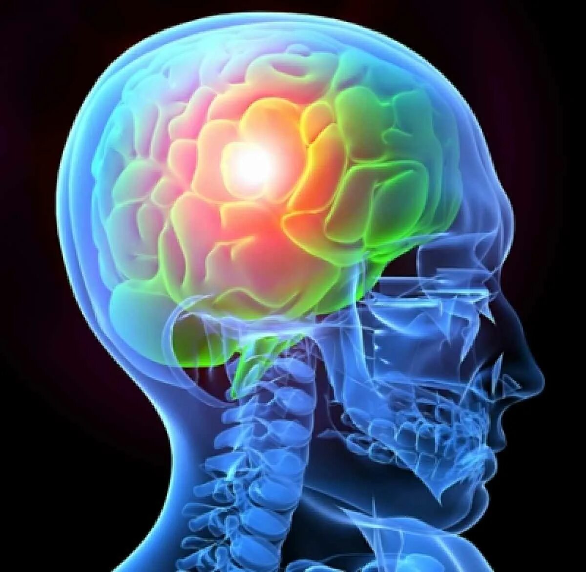 Brain injury. Мозг картинка.