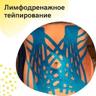 Схемы лимфодренажного тейпирования