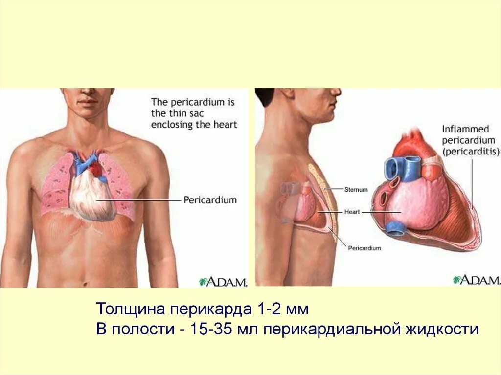 Скопление воздуха и крови в перикарде. Перикард жидкость в перикарде. Перикард жидкость в перикарде норма. Жидкость в области перикарда что это такое.