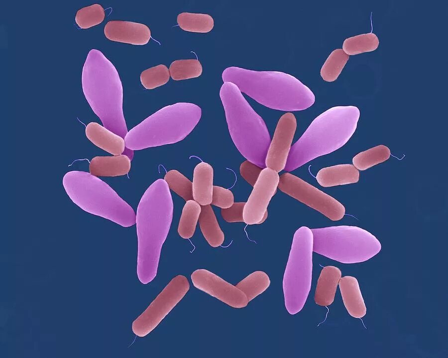 Клостридий перфрингенс. Clostridium perfringens возбудитель. Клостридии перфрингенс микроскопия. Перфрингенс (CL. Perfringens).