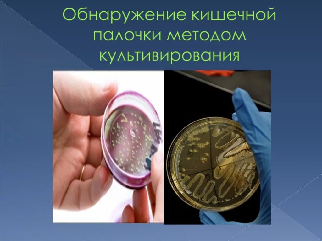 В икре обнаружили кишечную палочку