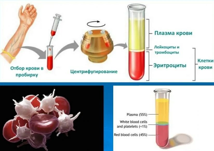 Повышенные эритроциты и гематокрит у ребенка