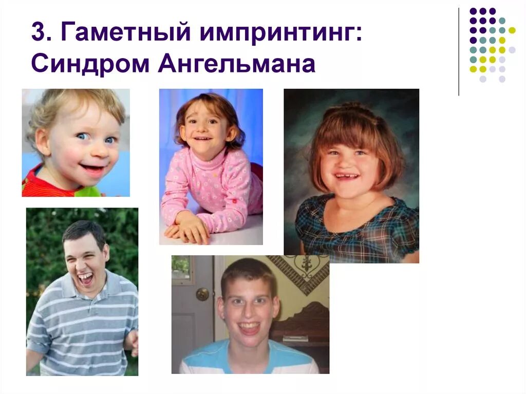 Синдром ангельмана сын. Синдром ангельмана (синдром «счастливой куклы»). синдром ангельмана фото. синдром ангельмана частота встречаемости.