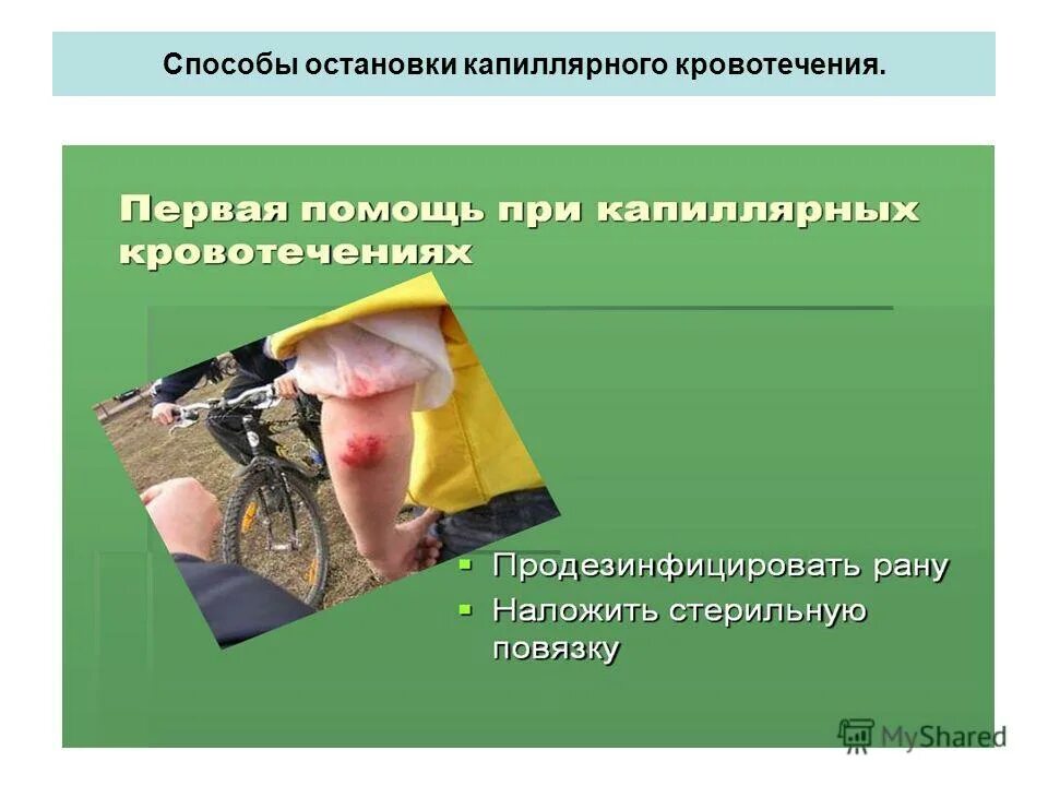 капиллярные способы остановки. капиллярные способы остановки. правильный способ остановки капиллярного кровотечения кратко. капиллярные способы остановки. временные методы остановки кровотечения.