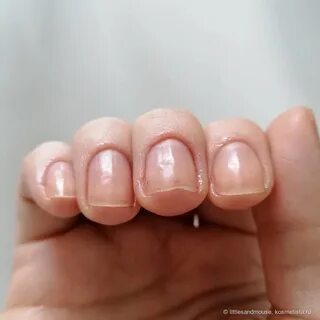 Лечение ногтей после гель лака