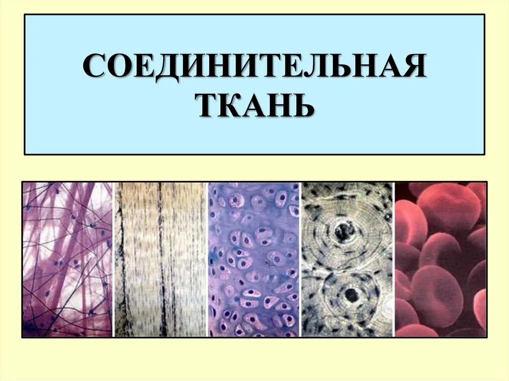 Подвиды соединительной ткани. Соединительная ткань зарисовать. Соединительная ткань соединительная ткань. Как выглядят клетки соединительной ткани. Основное группа ткани человека