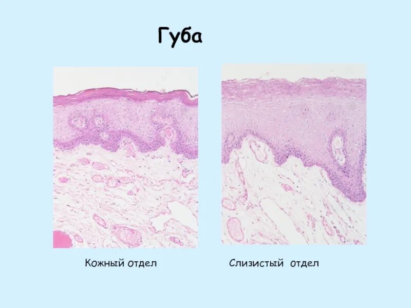 Слизистая оболочка ротовой полости гистология. Промежуточный отдел губы гистология. Слизистый отдел губы гистология. Строение губы гистология. Клетки слизистой полости рта