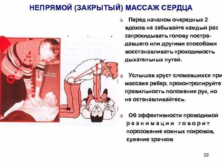 Что свидетельствует об эффективности непрямого массажа сердца. Сдавлением дыхательных путей. травматический шок синдром длительного сдавления. проходимость дыхательных путей при травматическом шоке. хруст при массаже сердца.