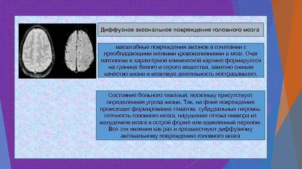 Тип поражения аксональный. Диффузное аксональное поражение головного мозга. Аксональные повреждения головного мозга. Диффузное аксональное повреждение головного. Причины диффузных поражений головного мозга.