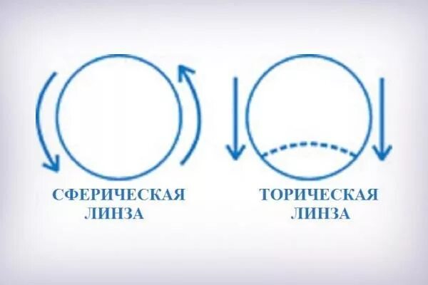 Можно линзы при астигматизме. Торические линзы корректирующие астигматизм. сферические и торические линзы. сферические линзы при астигматизме. торические линзы для очков при астигматизме.