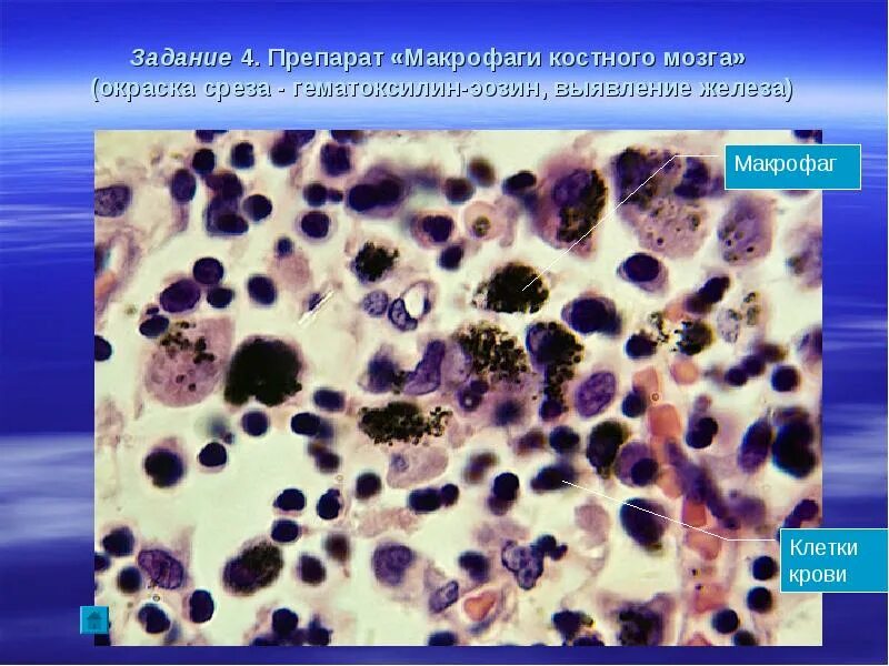 Макрофаги гистология. Макрофаг гистологический препарат. Макрофаг гистология препарат. Макрофаги соединительной ткани. Железо в макрофагах