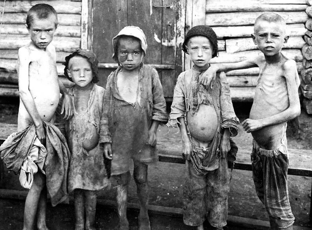 Голод во рту. Голод 1932-1933 в Поволжье 1932. Голодающие дети Поволжья.