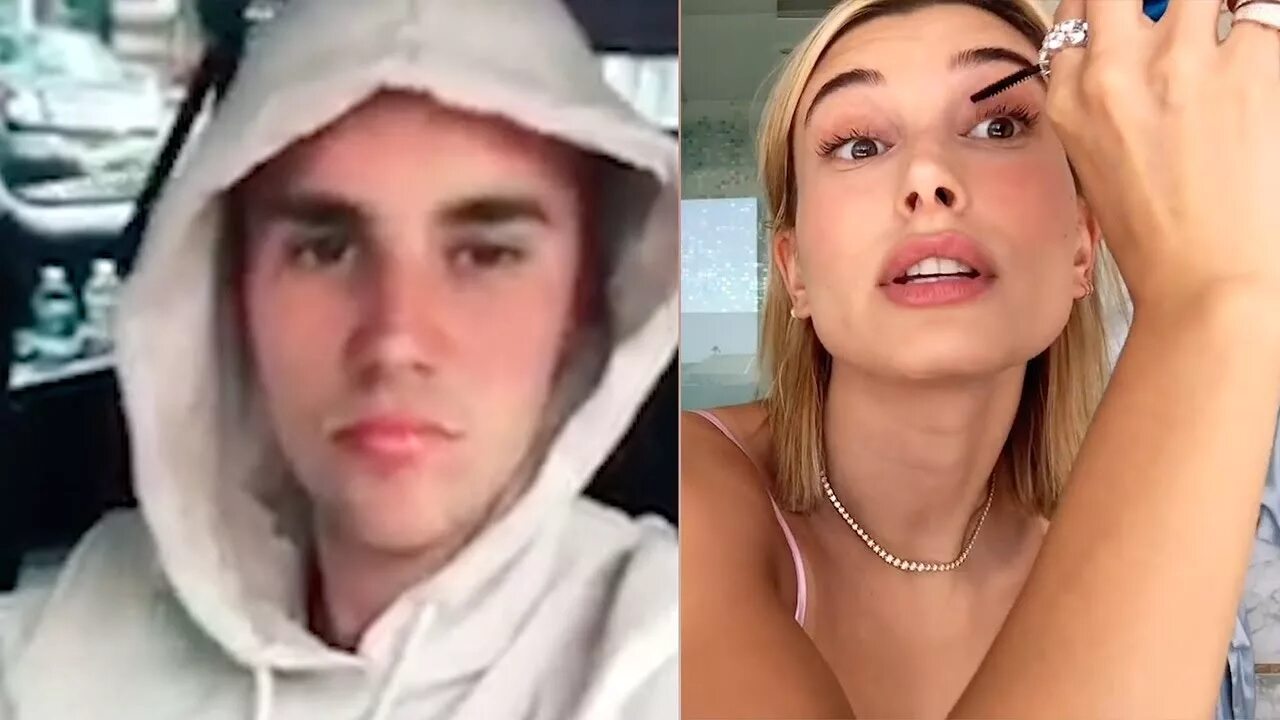 ipotesi ignoranza vita hailey bieber lip injections coccolare secondario attrice