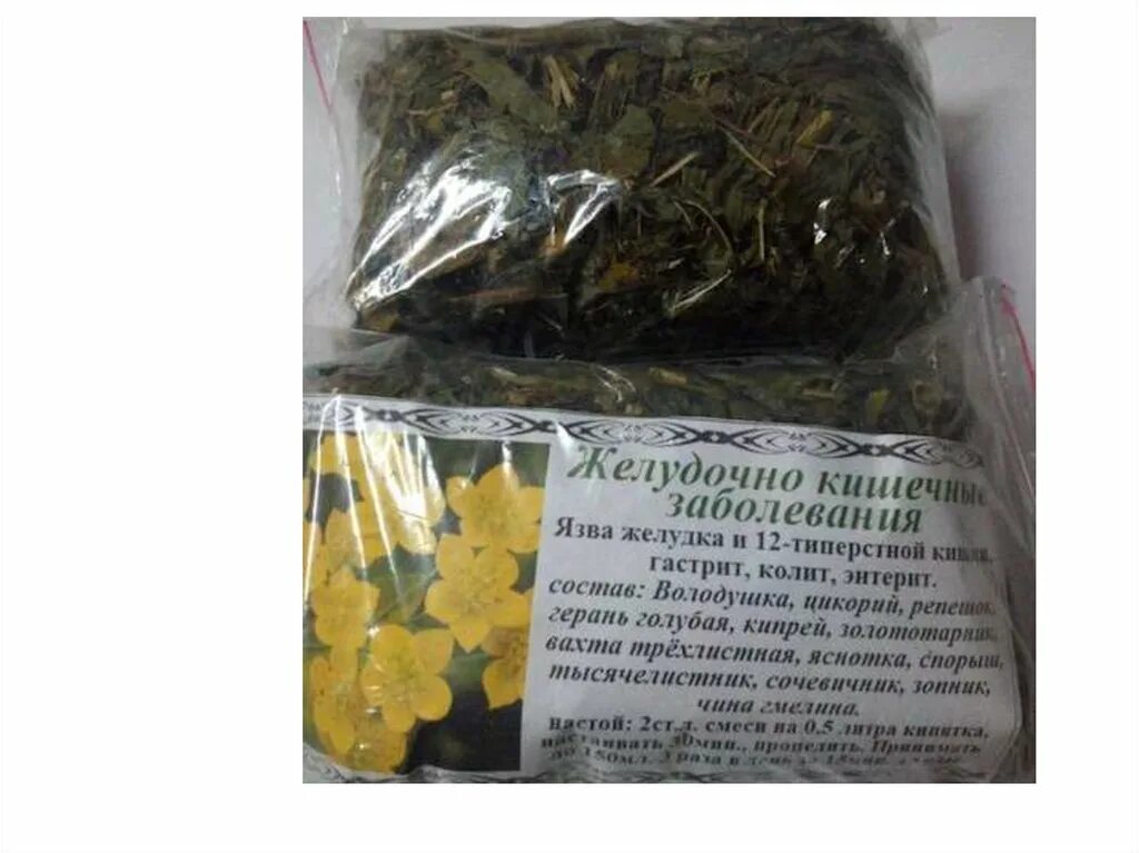 Какую траву пить при язве. Травы при язвенном колите кишечника. травы от язвы желудка. травы при язве кишечника. название трав для желудка.