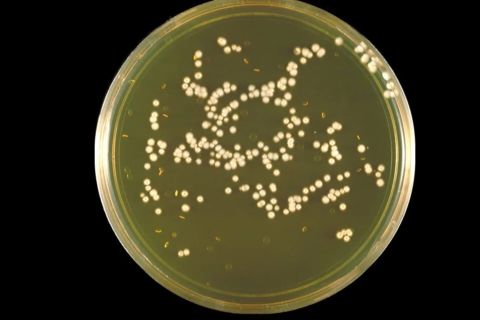 бранхиомикоз (жаберная гниль). ихтиофтириоз моллинезии. рыба кандида. рыба кандида. марианский липарис.