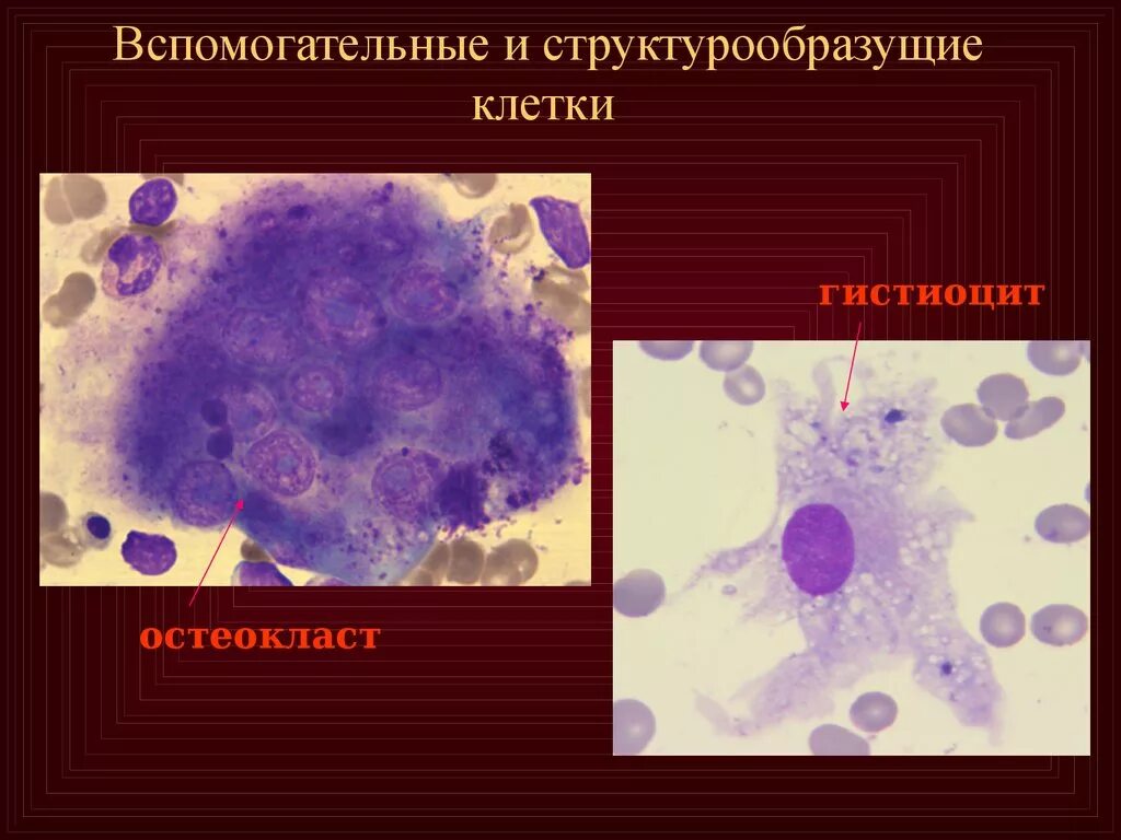 Макрофаги препарат. Макрофаги гистиоциты. Гистиоциты гистология. Макрофаги гистология. Гистология макрофаги клетки.