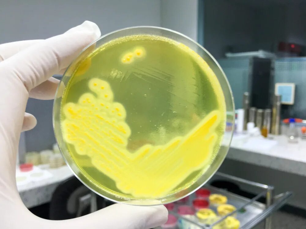 Стафилококк ауреус Петри. Стафилококк золотистый Staphylococcus aureus. S. aureus золотистый стафилококк. Стафилококк ауреус в чашке Петри.