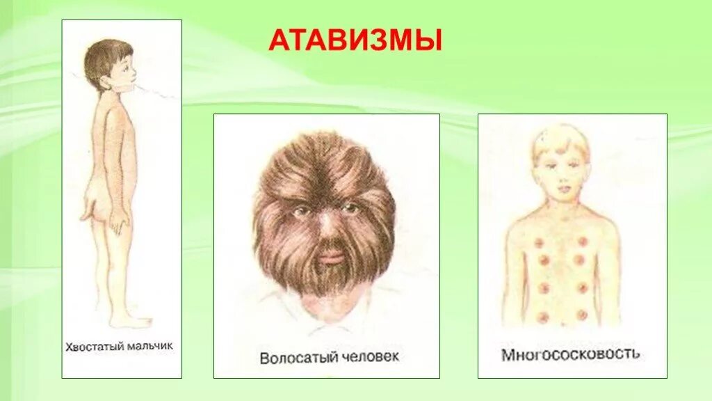 Рудимент 2 атавизм. Атавизмы у человека многососковость. хвостатый мальчик атавизмы у человека.