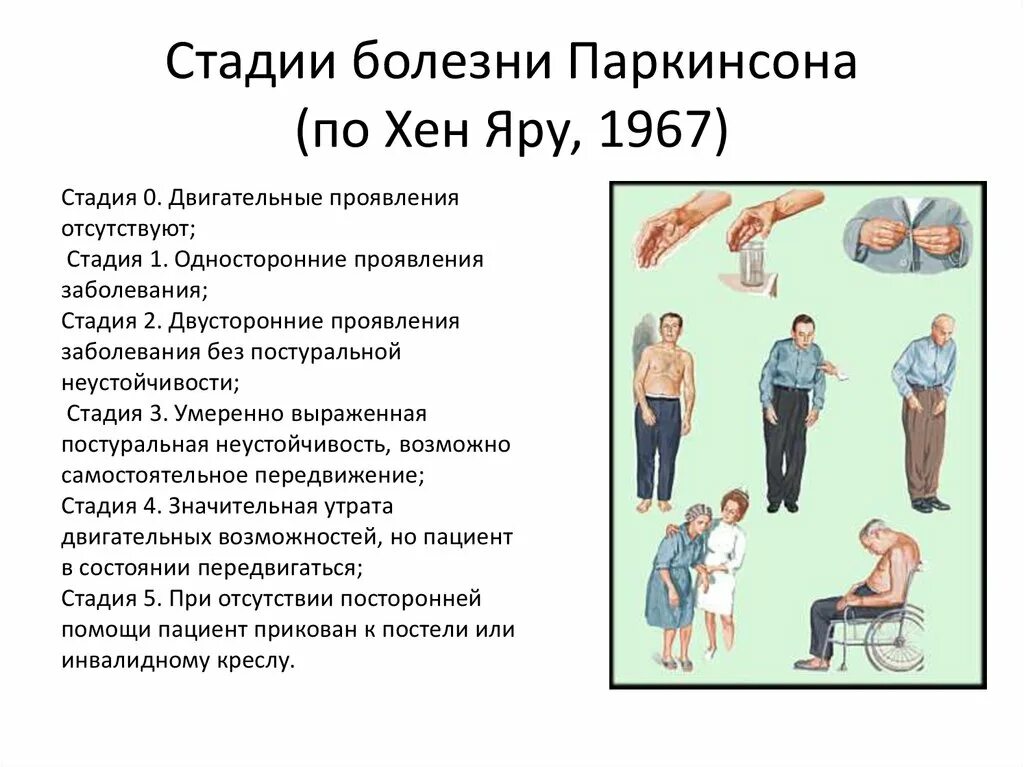 Болезнь Паркинсона акинетико-ригидная форма 3 стадия по Хен-Яру. Классификация Паркинсона по Хен и Яру. Болезнь Паркинсона 2 стадия по Хен-Яру. Паркинсон 2 степени по Хен Яру.