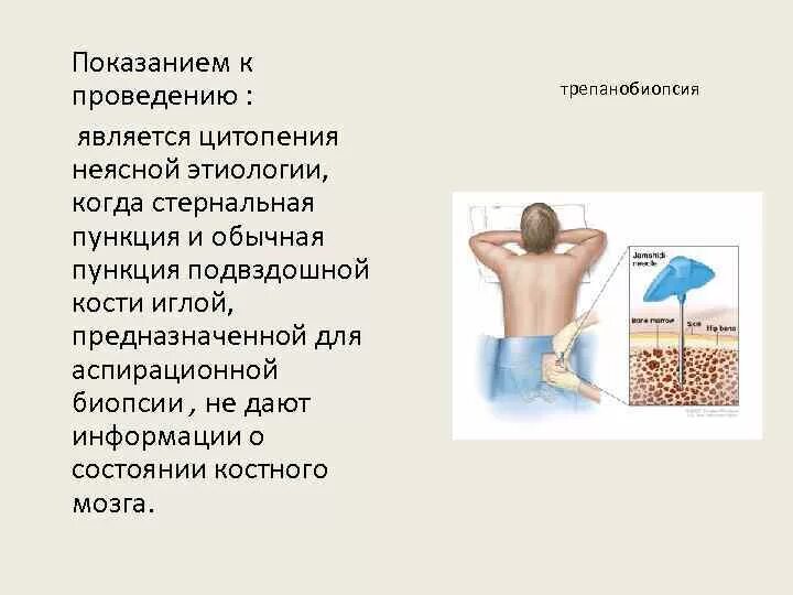 Костный мозг какие заболевания. Показания к исследованию костного мозга. Биопсия костного мозга показания. Техника проведения пункции костного мозга. Пункция красного костного мозга из грудины.