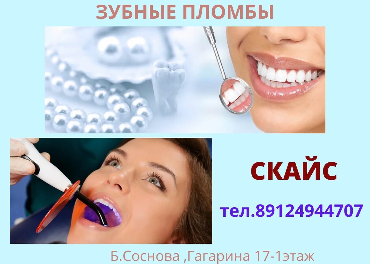 Удалить зуб пермь. Украшение для зубов скайсы. скайс фиксация в стоматологии.