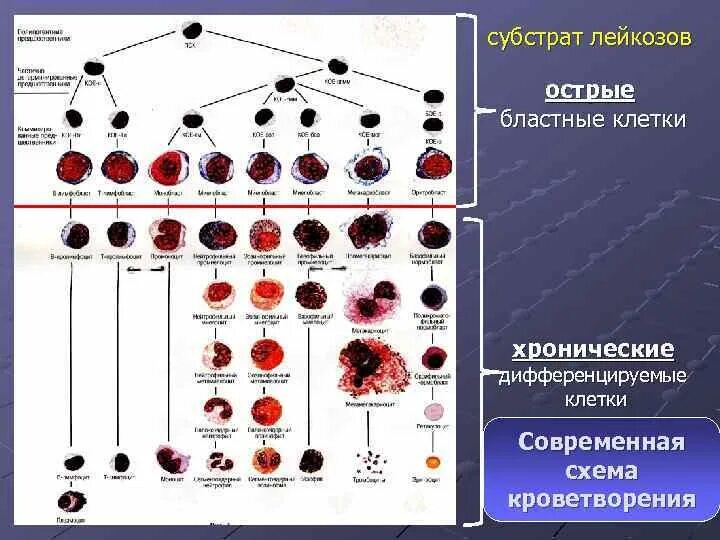 Обеспечивает кроветворение. Схема кроветворения лейкозы. Лейкоз схема гемопоэза. Схема кроветворения гистология. Система кроветворения при лейкозах.