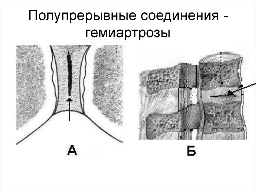 Лобковые кости соединение. Полусуставы гемиартрозы. Симфиз непрерывный соединение костей. Гемиартрозы симфизы. Полупрерывные соединения.