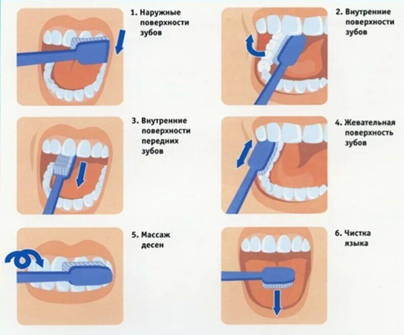 Уход за полостью рта больного. Методы чистки зубов стандартный метод. Стандартный метод чистки зубов методика. Алгоритм правильно чистить зубы. Правильная методика чистки зубов зубной щёткой.