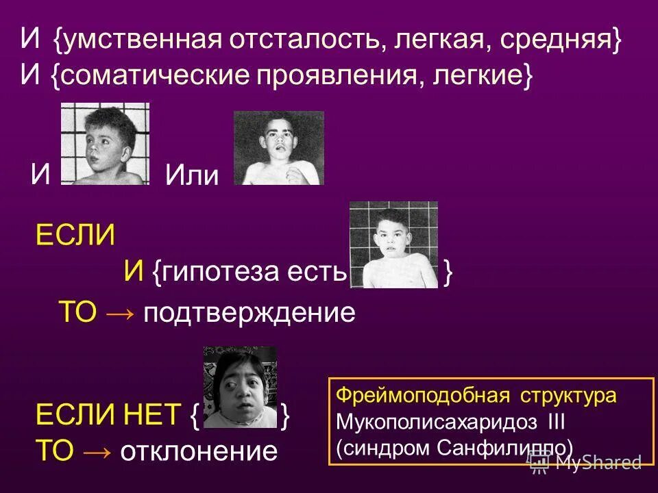 Легкая умственная отсталость образование. Умственная отсталость. Легкая умственная отсталость. Легкая олигофрения. Известные люди с умственной отсталостью.