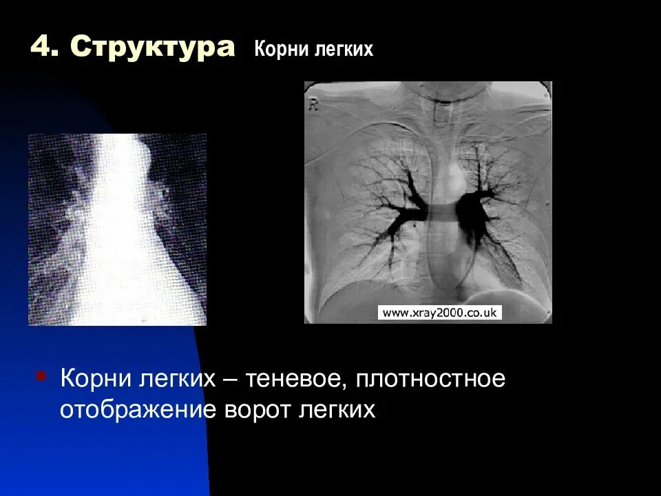 Корни легких структурны что это. Структура корня легкого. Корни легких структурные. Корни лёгких структурны что это.