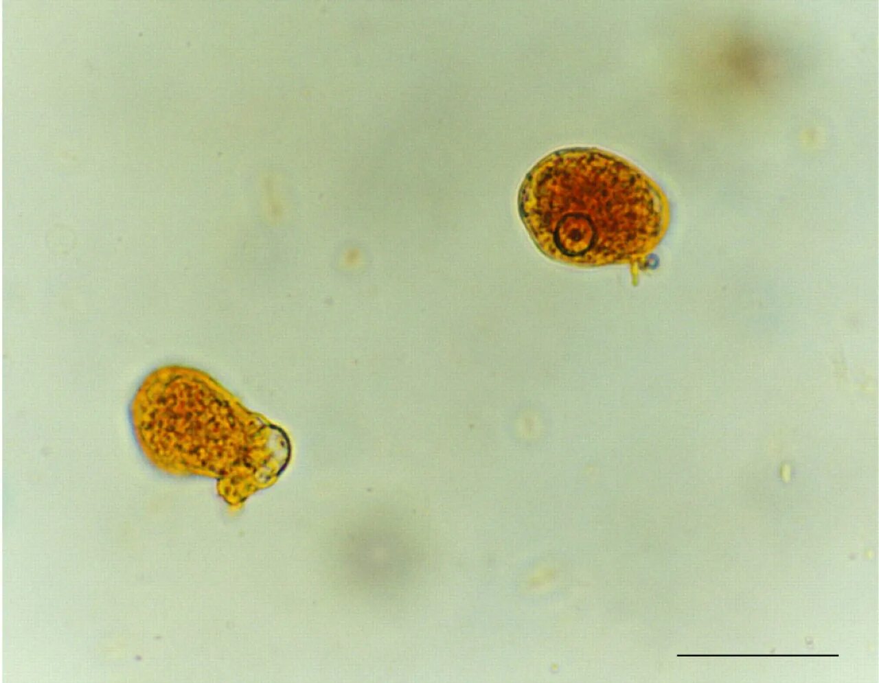 Cyclospora cayetanensis. Entamoeba histolytica trophozoite. Entamoeba coli в Кале у ребенка что это. Цисты цветок. Entamoeba coli в кале