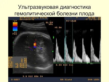 Диагностика плода