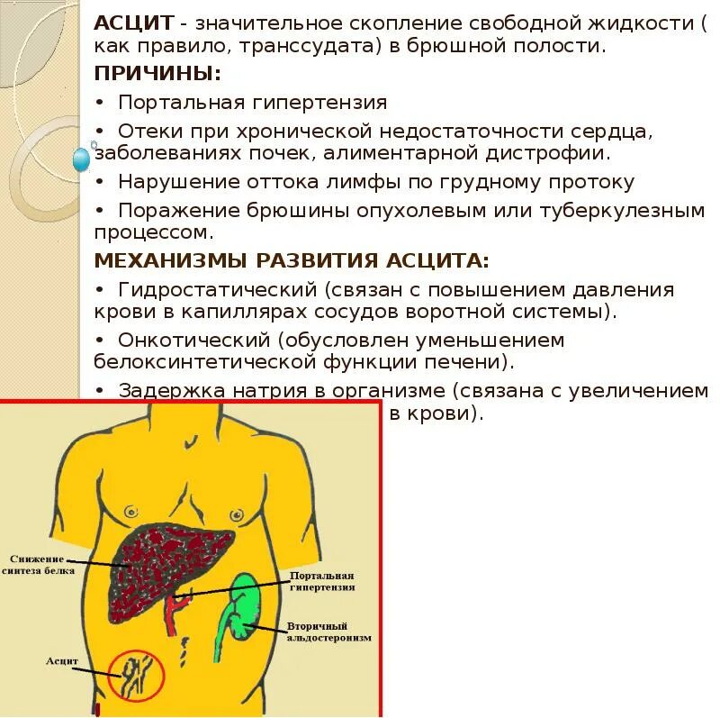 Что такое абдоминальная онкология. Жидкость в брюшной полости (асцит). Асцит (скопление жидкости в области живота),. Жидкость в брюшной полости симптомы. Асцит клинические проявления.