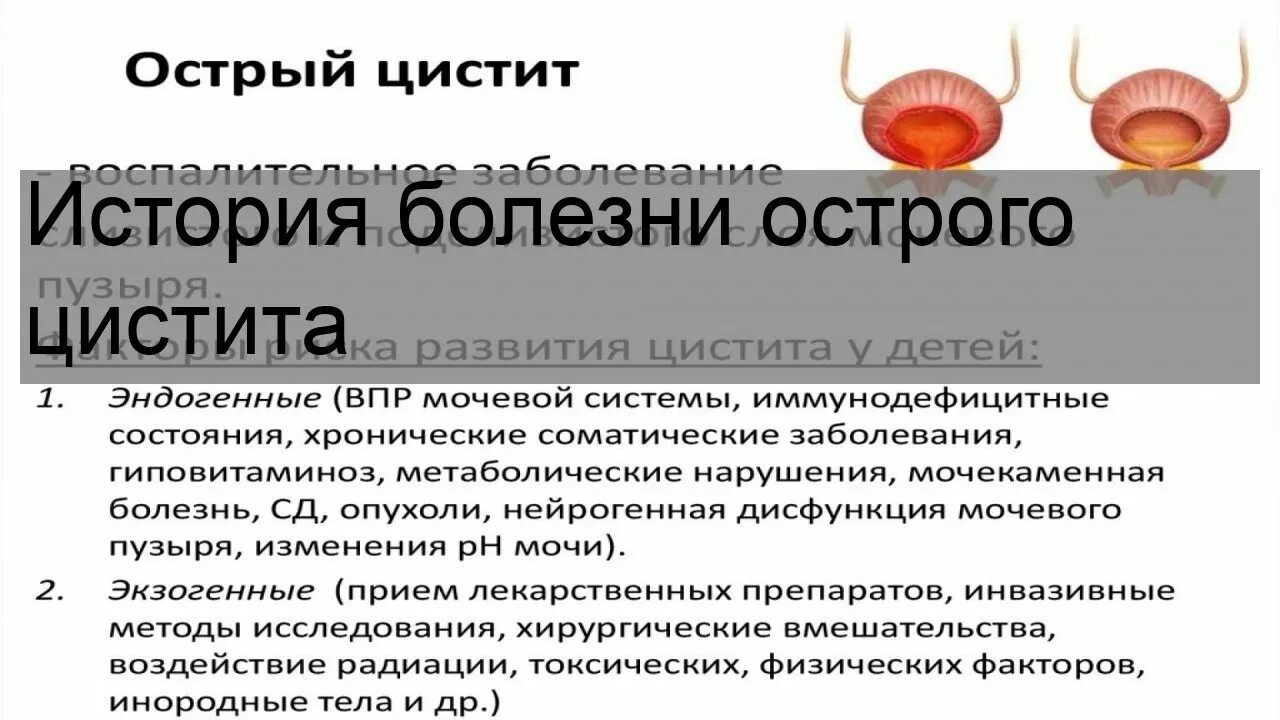 История болезни цистит