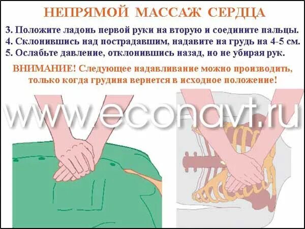 При непрямом массаже сердца пальцы располагаются. Непрямой массаж сердца положение рук. руки при непрямом массаже сердца. положение рук при непрямом массаже сердца. схема непрямого массажа сердца.