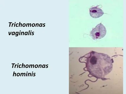 Trichomonas vaginālis