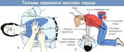 Как следует расположить руки