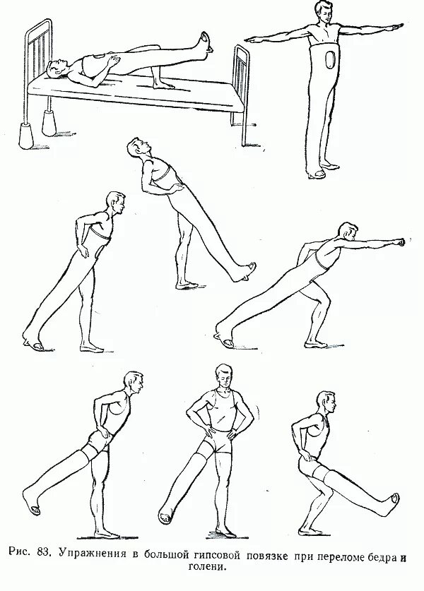 Гимнастика шейки бедра. ЛФК при переломе бедренной кости комплекс упражнений. Лечебная гимнастика после перелома бедренной кости. ЛФК после перелома бедренной кости упражнения. Комплекс ЛФК после перелома бедра.