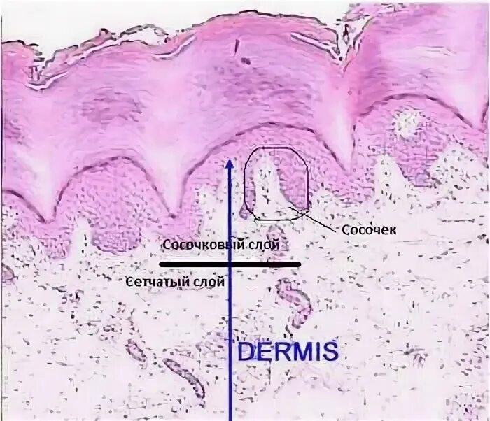 Сосочковый и сетчатый слой кожи. Сосочковый слой и сетчатый слой. Сосочковый слой дермы гистология. Сетчатый слой кожи препарат.