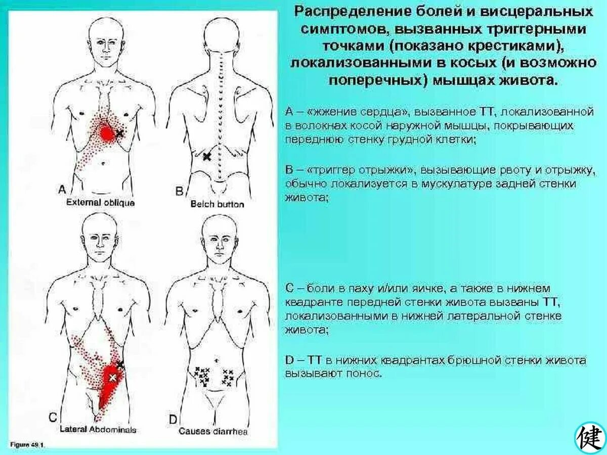 Точка спереди. Триггерные точки наружной косой мышцы живота. Болевые точки живота. Триггеры прямой мышцы живота. Триггерные точки на животе.